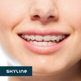 Skyline Dental - Clinica stomatologica premium